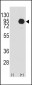 B-RAF Antibody (S445)