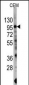 PIK3CG Antibody (S1100)