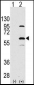 ELP3 Antibody (N-term)