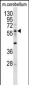 ELP3 Antibody (N-term)