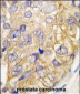 DRAGON (RGMB) Antibody (C-term)