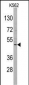 DRAGON (RGMB) Antibody (C-term)