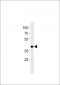 HDBP1 Antibody (Center)