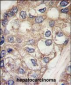 AFP Antibody (Center)