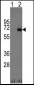 AFP Antibody (Center)