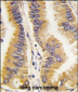 FRAT1 Antibody (C-term)