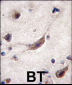 ERAS Antibody (N-term) (A28)