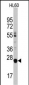 LIN28B Antibody (C-term)