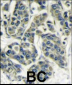 S6K (RPS6KB1) Antibody (Center)