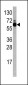 S6K (RPS6KB1) Antibody (Center)