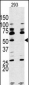 S6K (RPS6KB1) Antibody (Center)