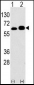 S6K (RPS6KB1) Antibody (Center)