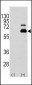 S6K (RPS6KB1) Antibody (S404)