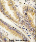 Anterior Gradient 2 (AGR2) Antibody (N-term)