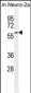 Parp6 Antibody (C-term 503)