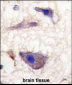NP1(Nptx1) Antibody (C-term)