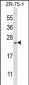 BarX1 Antibody (Center)