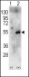 RPS6KB2 Antibody (Center)