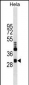 CLIC4 Antibody