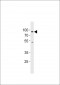 HBO1/MYST2 Antibody (C-term)