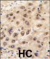 Nucleostemin (GNL3) Antibody (C-term)