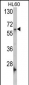 Nucleostemin (GNL3) Antibody (C-term)