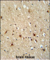 Rax Antibody (N-term)