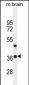 Rax Antibody (N-term)