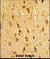 H Cadherin (CDH13) Antibody (N-term)