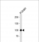 H Cadherin (CDH13) Antibody (N-term)