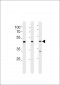 DAX1 (NR0B1) Antibody (N-term)