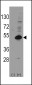 DAX1 (NR0B1) Antibody (C-term)