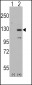 DAAM1 Antibody (N-term)