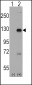 DAAM1 Antibody (C-term)