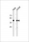 MAPK14 Antibody (T179)