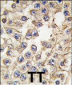 EPHA10 Antibody (Center)