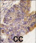 RPS6KA1 Antibody (S732)