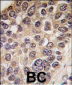 PIK3CD Antibody (Y485)