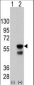 PINK1 Antibody (Ascites)