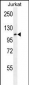 JHDM1a/FBXL11 Antibody (Center)