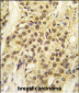 HMOF/MYST1 Antibody (C-term)