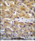 CHRD Antibody (N-term)
