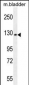 CHRD Antibody (N-term)