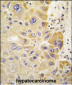 ALDH2 Antibody (Center)