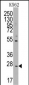 CD8B Antibody (N-term)