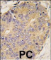 BMP15 Antibody (Center)