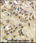 MYC Antibody (T58)