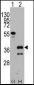 ZIC4 Antibody (C-term)