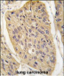 WIF1 Antibody (N-term)