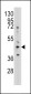 S adenosylhomocysteine hydrolase (ACHY) Antibody (N-term)